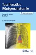 Möller / Reif |  Taschenatlas Röntgenanatomie | Buch |  Sack Fachmedien