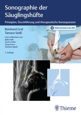 Graf / Seidl | Sonographie der Säuglingshüfte | E-Book | sack.de