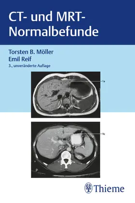 Möller / Reif | CT und MRT Normalbefunde | Buch | 978-3-13-245307-4 | sack.de