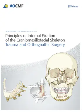 Prein / Ehrenfeld / Manson |  Principles of Internal Fixation of the Craniomaxillofacial Skeleton | Buch |  Sack Fachmedien