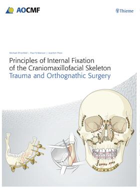 Prein / Ehrenfeld / Manson | Principles of Internal Fixation of the Craniomaxillofacial Skeleton | Medienkombination | sack.de