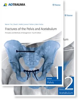 Tile / Helfet / Kellam | Fractures of the Pelvis and Acetabulum (AO) | Medienkombination | 978-3-13-245319-7 | sack.de