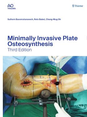 Bavonratanavech / Babst / Oh | Minimally Invasive Plate Osteosynthesis | E-Book | sack.de