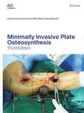 Bavonratanavech / Babst / Oh |  Minimally Invasive Plate Osteosynthesis | eBook | Sack Fachmedien