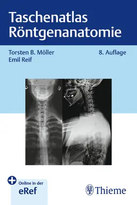 Möller / Reif | Taschenatlas Röntgenanatomie | Medienkombination | 978-3-13-246007-2 | sack.de