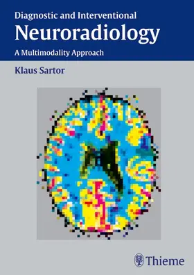 Sartor |  Diagnostic and Interventional Neuroradiology | eBook | Sack Fachmedien