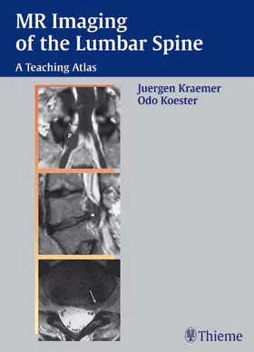 Kraemer / Koester |  MR Imaging of the Lumbar Spine | eBook | Sack Fachmedien