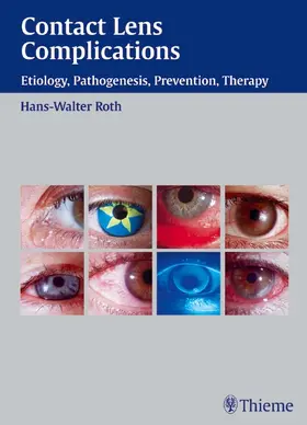 Roth | Contact Lens Complications | E-Book | www.sack.de