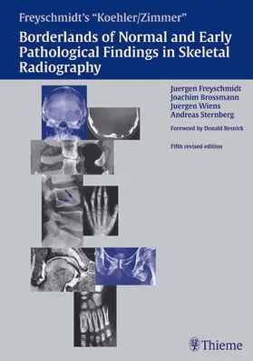 Freyschmidt / Brossmann / Sternberg |  Freyschmidt's "Koehler/Zimmer" Borderlands of Normal and Early Pathological Findings in Skeletal Radiography | eBook | Sack Fachmedien
