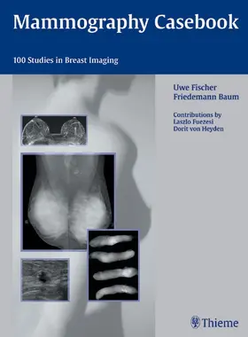 Fischer |  Mammography Casebook | eBook | Sack Fachmedien