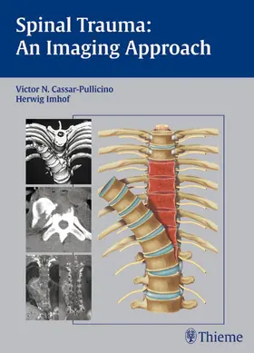 Cassar-Pullicino / Imhof | Spinal Trauma - An Imaging Approach | E-Book | www.sack.de