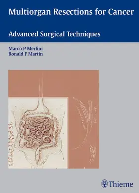 Merlini / Martin | Multiorgan Resections for Cancer | E-Book | sack.de