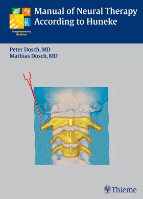 Dosch | Manual of Neural Therapy According to Huneke | E-Book | www.sack.de