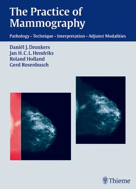Dronkers / Hendriks / Holland |  The Practice of Mammography | eBook | Sack Fachmedien