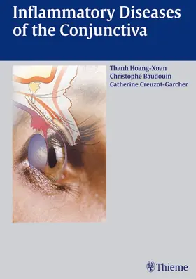 Hoang-Xuan / Baudouin / Creuzot-Garcher |  Inflammatory Diseases of the Conjuctiva | eBook | Sack Fachmedien