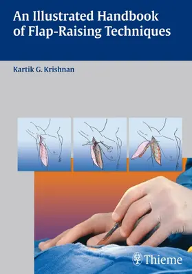 Krishnan | An Illustrated Handbook of Flap-Raising Techniques | E-Book | www.sack.de