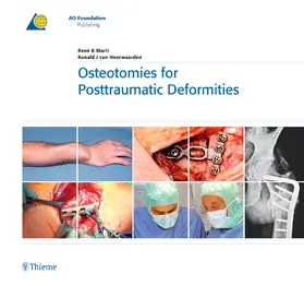 Marti / van Heerwaarden |  Osteotomies for Posttraumatic Deformities | eBook | Sack Fachmedien