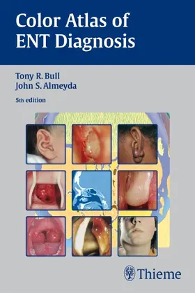 Bull / Almeyda |  Color Atlas of ENT Diagnosis | eBook | Sack Fachmedien