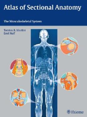 Möller / Reif | Atlas of Sectional Anatomy | E-Book | sack.de