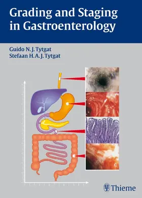 Tytgat |  Grading and Staging in Gastroenterology | eBook | Sack Fachmedien