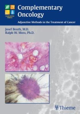 Beuth / Moss | Complementary Oncology | E-Book | sack.de