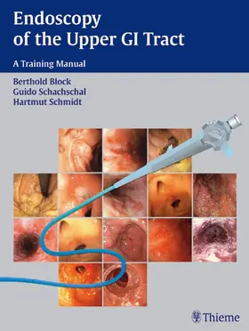 Block / Schachschal / Schmidt |  Endoscopy of the Upper GI Tract | eBook | Sack Fachmedien