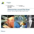Lobenhoffer / van Heerwaarden / Staubli |  Osteotomies around the Knee | eBook | Sack Fachmedien