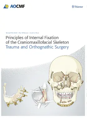 Ehrenfeld / Prein / Manson |  Principles of Internal Fixation of the Craniomaxillofacial Skeleton | eBook | Sack Fachmedien