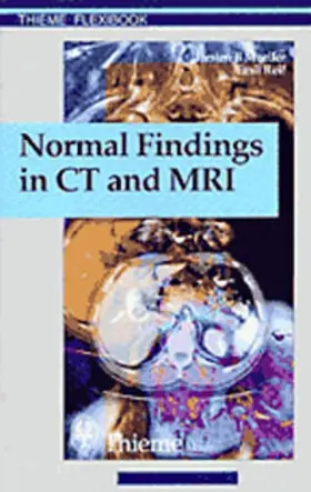 Möller / Moeller / Reif | Normal Findings in CT and MRI | E-Book | sack.de