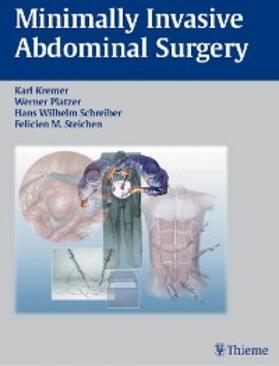 Kremer / Platzer / Schreiber |  Minimally Invasive Abdominal Surgery | eBook | Sack Fachmedien