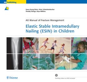 Dietz / Schmittenbecher / Slongo | Elastic Stable Intramedullary Nailing (ESIN) in Children | E-Book | sack.de