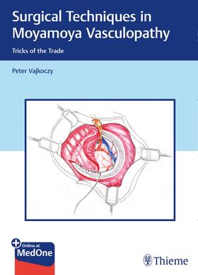 Vajkoczy | Surgical Techniques in Moyamoya Vasculopathy | E-Book | sack.de
