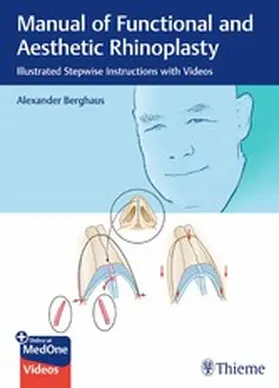 Berghaus |  Manual of Functional and Aesthetic Rhinoplasty | eBook | Sack Fachmedien