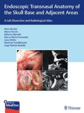 Nicolai / Ferrari / Maroldi | Endoscopic Transnasal Anatomy of the Skull Base and Adjacent Areas | E-Book | sack.de