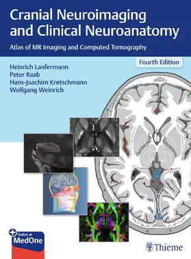 Lanfermann / Raab / Kretschmann | Cranial Neuroimaging and Clinical Neuroanatomy | Medienkombination | 978-3-13-672604-4 | sack.de