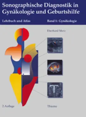 Merz |  Sonographische Diagnostik in Gynäkologie und Geburtshilfe. 01. Gynäkologie | Buch |  Sack Fachmedien
