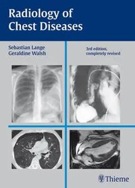 Walsh / Lange |  Radiology of Chest Diseases | Buch |  Sack Fachmedien