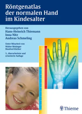 Thiemann / Nitz / Schmeling |  Röntgenatlas der normalen Hand im Kindesalter | Buch |  Sack Fachmedien