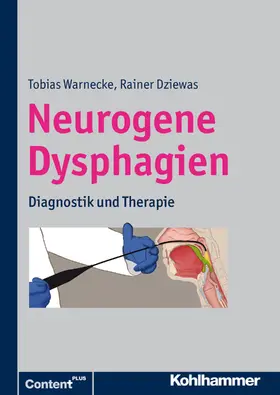 Dziewas / Warnecke |  Neurogene Dysphagien | eBook | Sack Fachmedien