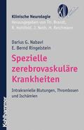 Nabavi / Ringelstein / Brandt |  Spezielle zerebrovaskuläre Krankheiten | eBook | Sack Fachmedien