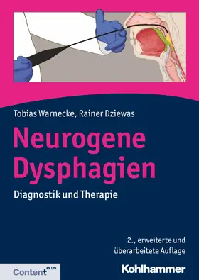 Dziewas / Warnecke |  Neurogene Dysphagien | eBook | Sack Fachmedien