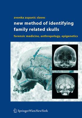 Zupanic Slavec | New Method of Identifying Family Related Skulls | Buch | 978-3-211-22044-3 | sack.de