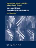 Manninger / Bosch / Cserháti |  Osteosynthese der Schenkelhalsfraktur | eBook | Sack Fachmedien