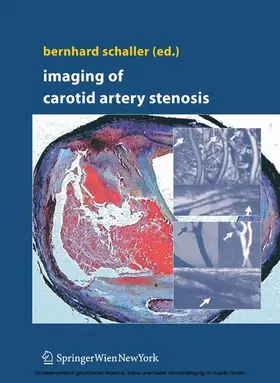 Schaller | Imaging of Carotid Artery Stenosis | E-Book | www.sack.de