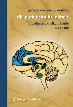 Riederer / Gerlach / Reichmann | Die Parkinson-Krankheit | Buch | 978-3-211-48307-7 | sack.de