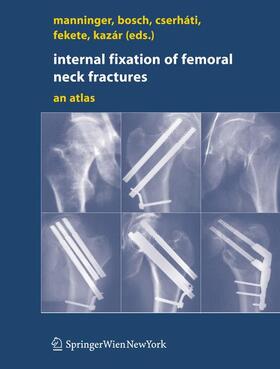 Manninger / Bosch / Kazár | Internal fixation of femoral neck fractures | Buch | 978-3-211-68583-9 | sack.de