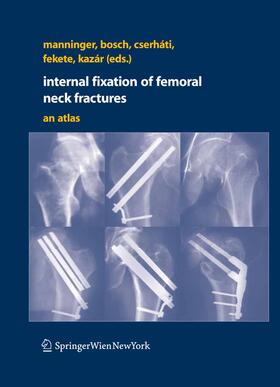 Manninger / Bosch / Cserháti | Internal fixation of femoral neck fractures | E-Book | sack.de