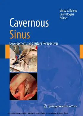 Dolenc / Rogers |  Cavernous Sinus | eBook | Sack Fachmedien