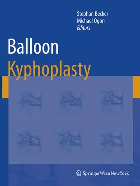 Ogon / Becker |  Balloon Kyphoplasty | Buch |  Sack Fachmedien