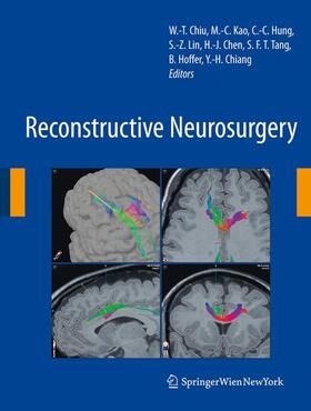 Chiu / Kao / Hung |  Reconstructive Neurosurgery | Buch |  Sack Fachmedien